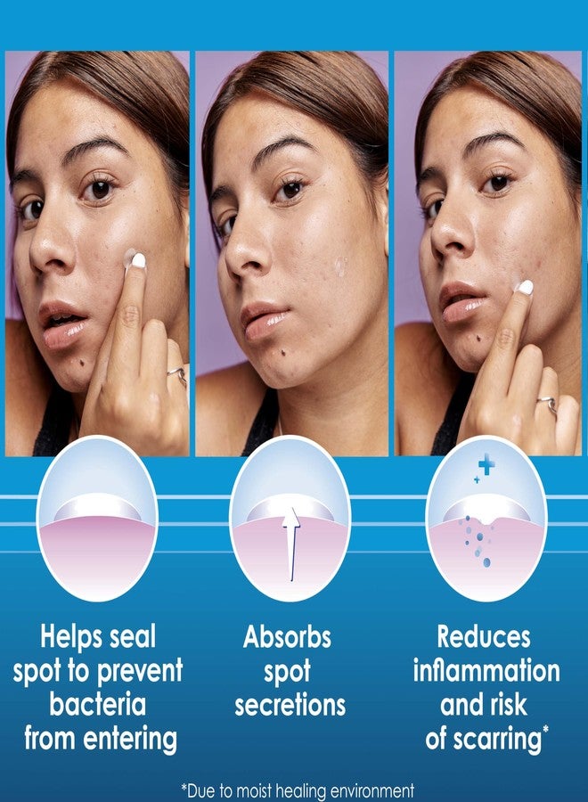 كليراسيل لصقات كليرزيل لعلاج حب الشباب ليلاً ونهاراً، بتقنية الهيدروكولويد، عبوة اقتصادية، 30 لصقة - Image 3